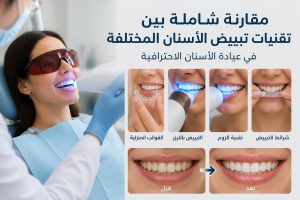 تبييض الأسنان: دليل شامل للحصول على ابتسامة مشرقة
