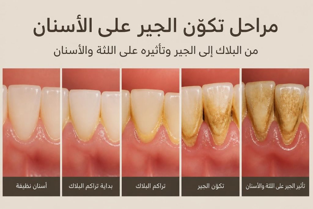جير الاسنان: الأسباب والأضرار وطرق الوقاية الفعالة